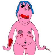 arm blue_hair closed_mouth deep_wound evil exposed_muscle frankenpenis ftm hair hand holding_knife holding_object knife masectomy masectomy_scars navel nipple nsfw penis pink_skin pooner scar smile soyjak stitches top_surgery tranny variant:gapejak // 1356x1403 // 373.9KB