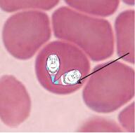Babesia blood irl_background parasite tranny variant:bernd // 440x436 // 157.2KB
