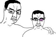 2soyjaks arm body bruise bruised_eye hair hand looking_at_you soyjak subvariant:chudjak_front template variant:chudjak // 1265x834 // 67.5KB